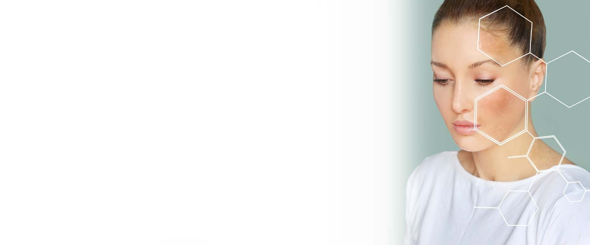 Laser skin treatment at Perfect U Clinic Bangalore